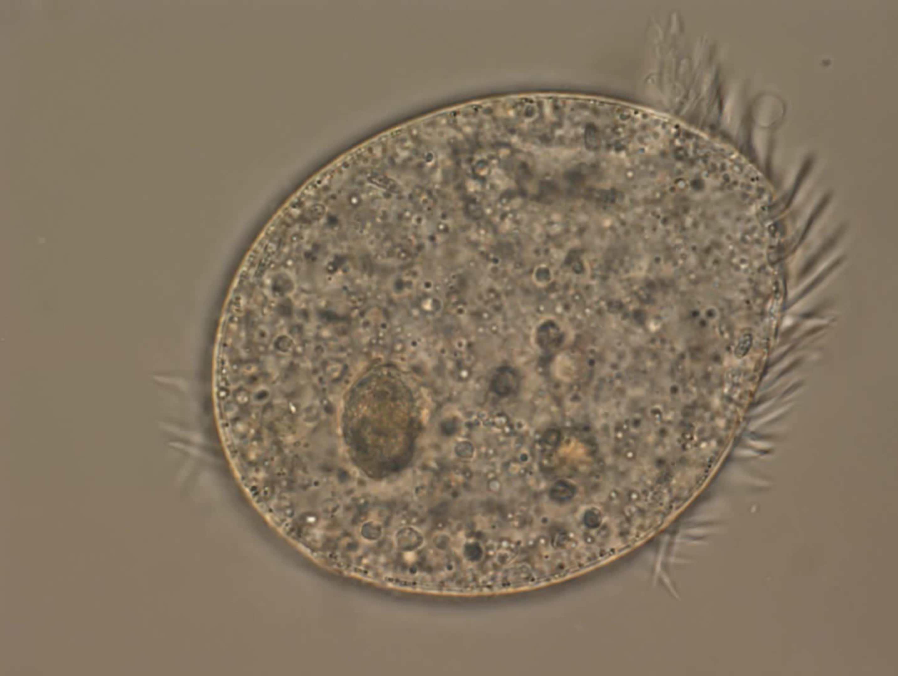 纤毛虫显微镜图片