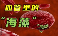 钻进人类血管的“海藻”