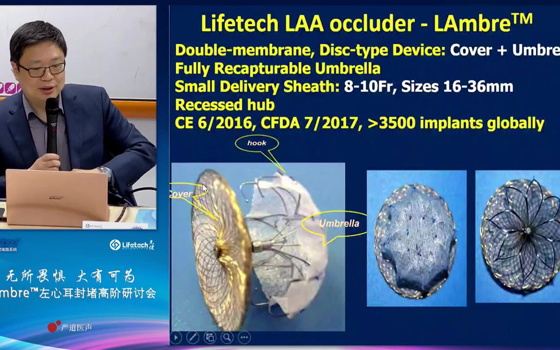【转载】left atrial appendage closure (林逸贤 极简式左心耳封堵)