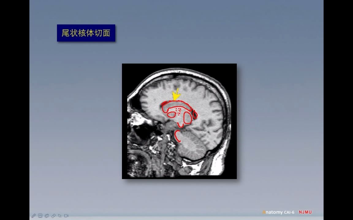 [图]头部矢状面断层解剖(磁共振影像)