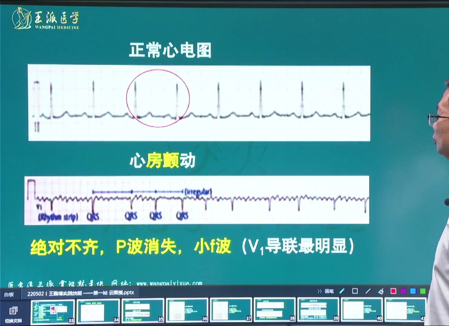 王博心电图医考必考点专讲房颤哔哩哔哩bilibili