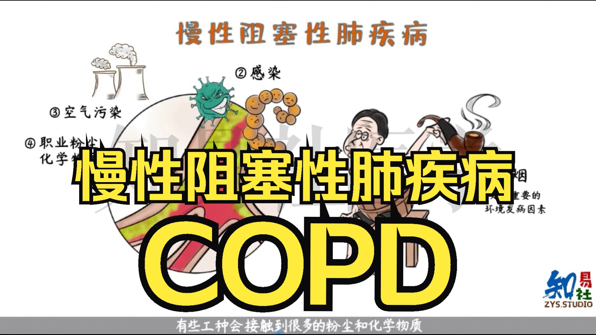 绘画内科学 慢性阻塞性肺疾病(COPD)哔哩哔哩bilibili