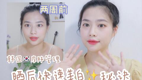 夏日无顾虑 韩国皮肤管理方式2周白回来旅行季 防晒肯定是必须 旅行后这样弥补白回来并不是分享美白的东西 是韩国的皮肤科和韩国女生常用的处理方法 哔哩哔哩 Bilibili 夏日无顾虑 韩国皮肤管理方式2周白回来旅行季 防晒肯定是必须 旅行后这样弥补白回来并不是分享美白的东西 是韩国的皮肤科和韩国女生常用的处理方法 哔哩哔哩 Bilibili