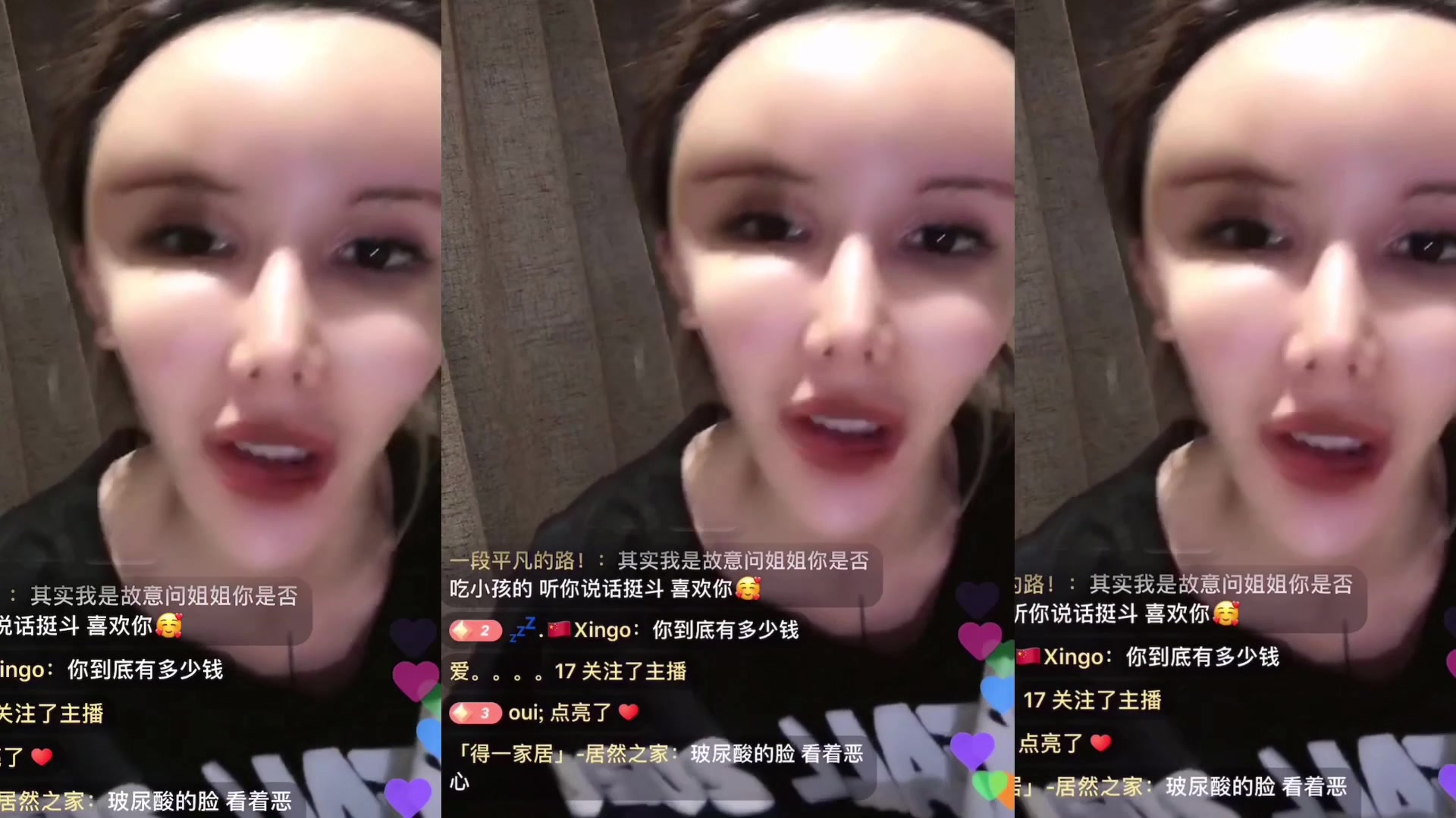 整容网红主播可爱熙心态是真的好说自己打的是90年的玻尿酸他还有男