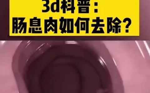 如何治疗肠道息肉?采用内窃镜套圈、钳除、电切等治疗手段,对息肉给予根除.电子肠镜集探查、治疗于一体,恢复肠道健康哔哩哔哩bilibili