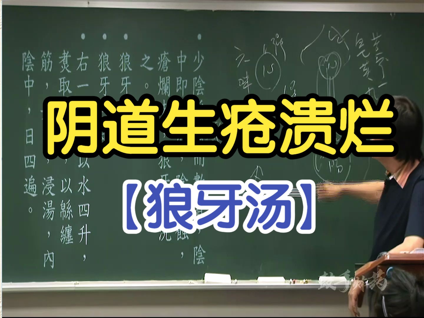 191 阴道生疮溃烂(狼牙汤)【倪海厦金匮要略】哔哩哔哩bilibili