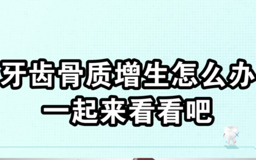 牙齿骨质增生是什么?牙齿骨质增生了怎么办呢?一起来看看吧!哔哩哔哩bilibili