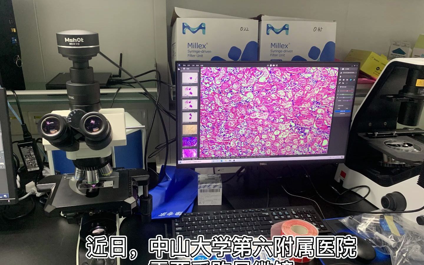 明美显微镜走进中山大学第六附属医院哔哩哔哩bilibili