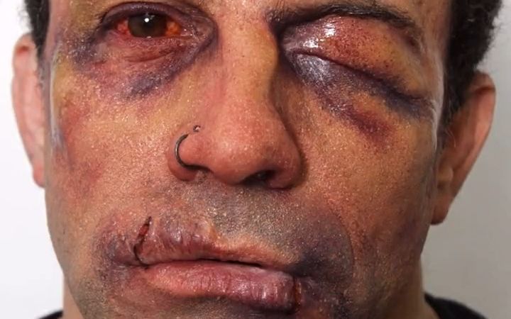 【特效化妆】伤效妆