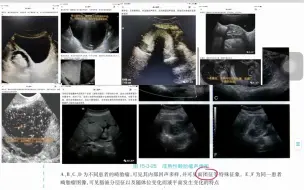 Download Video: 超声结业考病例打卡
