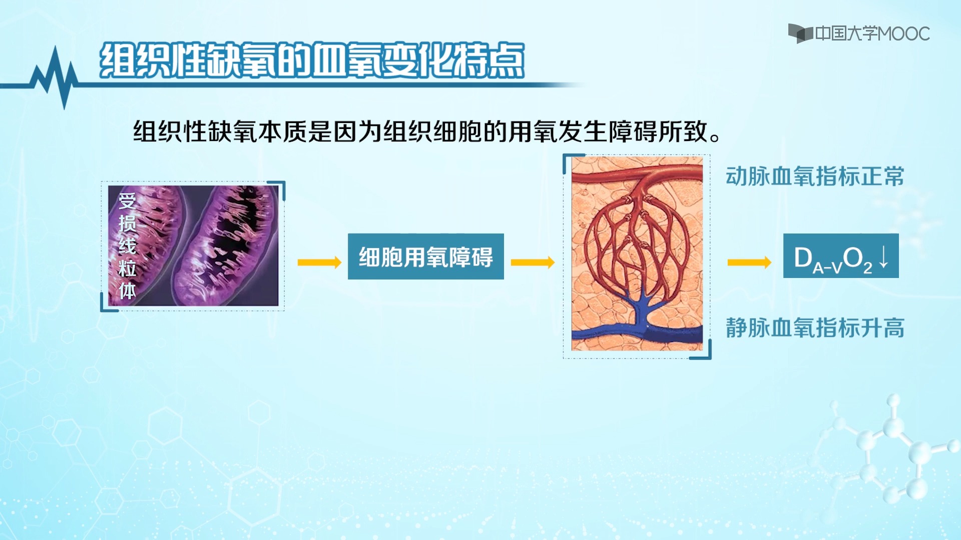 5.1]--5.5 组织性缺氧