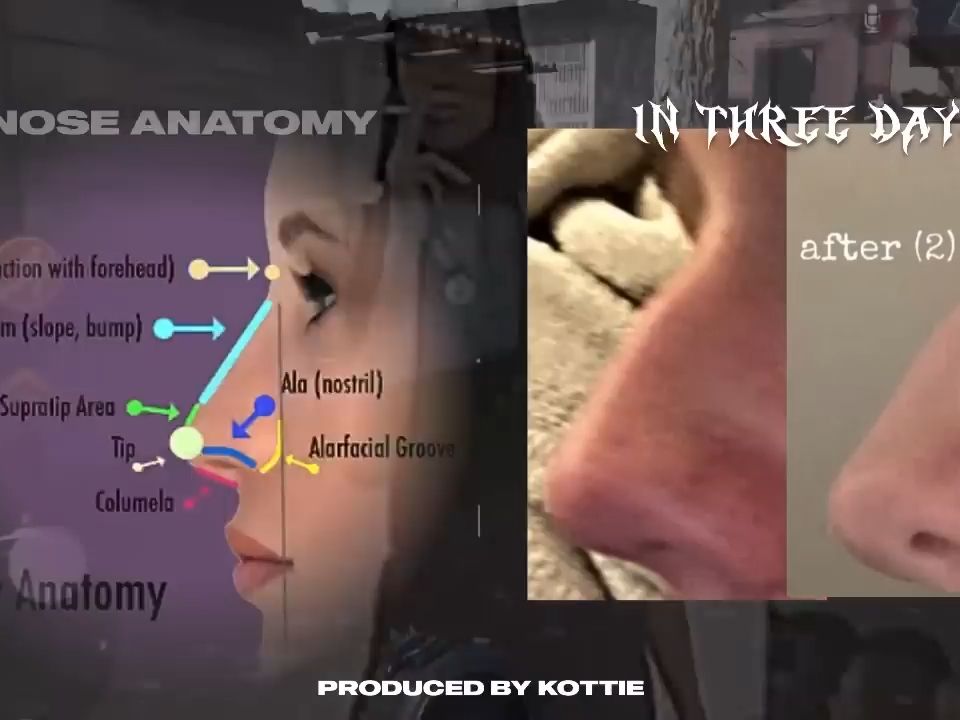 KOTTIE:解剖学上完美的鼻子变形 (反馈超好，单发一遍)