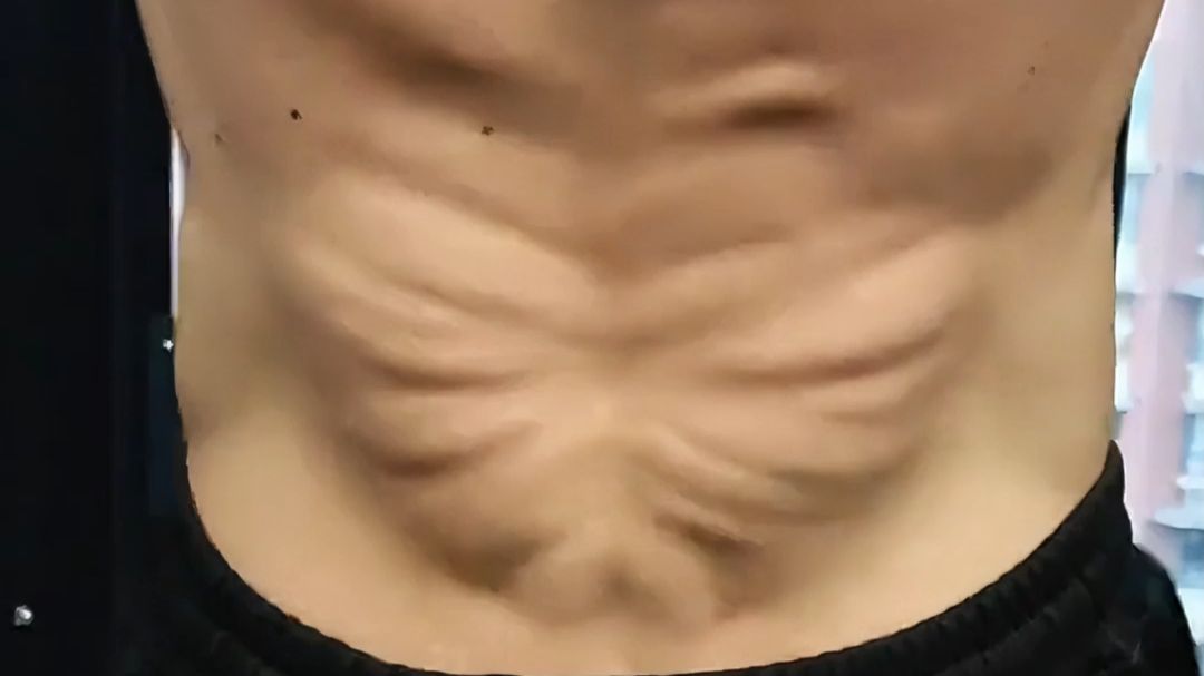 小伙背部肌肉好似“抱脸虫”，网友：这是怎么练出来的？