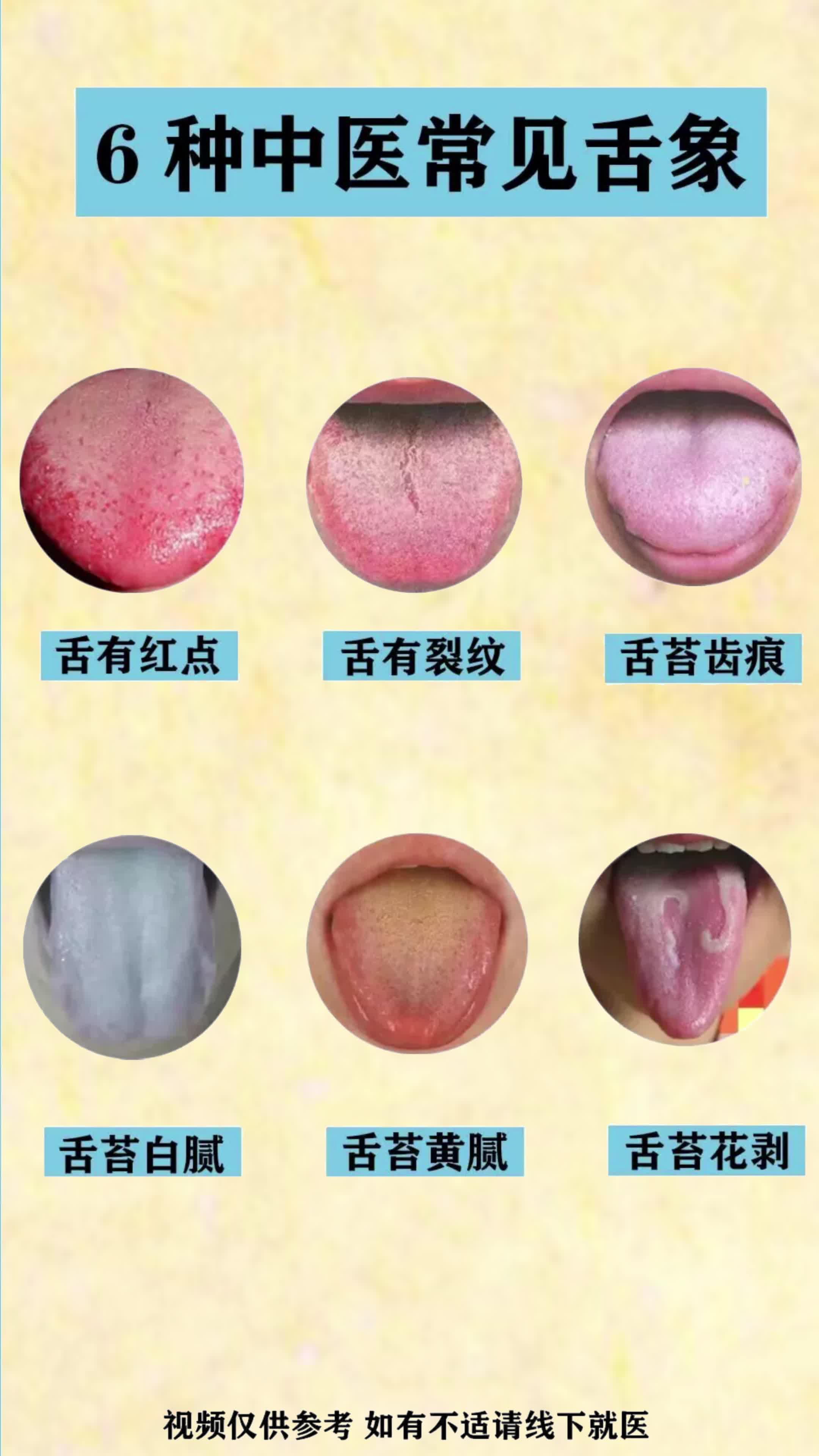六种中医常见舌象 看你有吗?