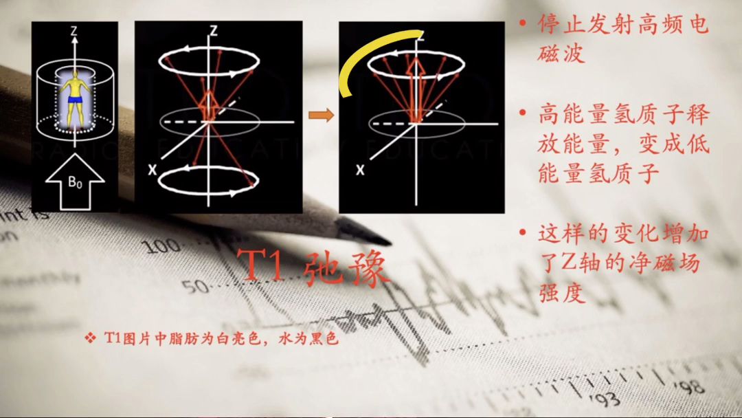 核磁共振成像原理哔哩哔哩bilibili