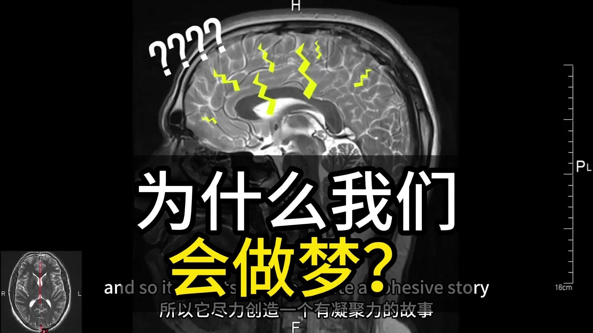 为什么做梦多是什么原因百科在线