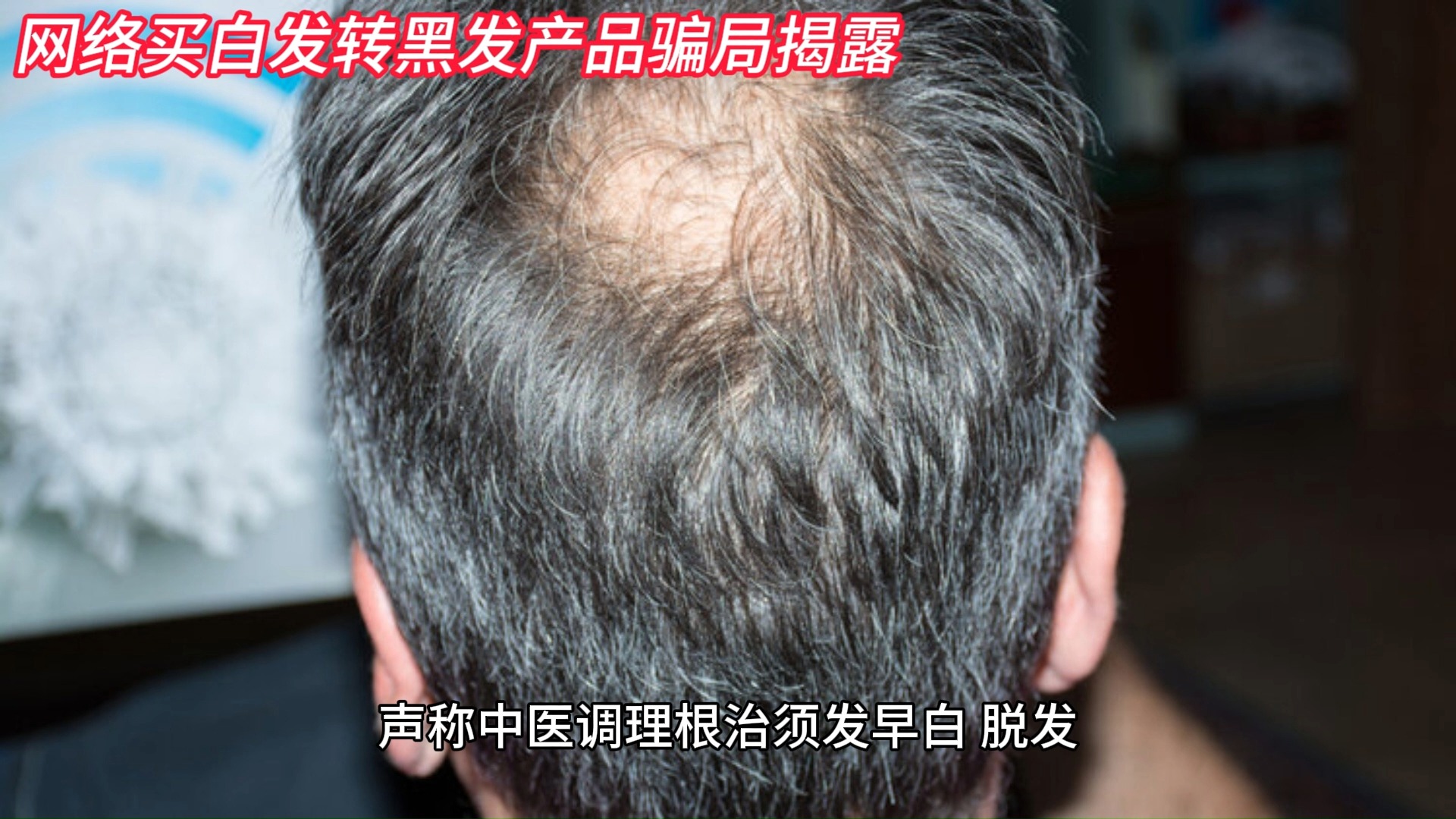 网络买白发转黑发产品骗局揭露,止损了可以追回损失吗?