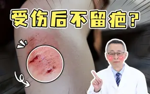 Download Video: 【皮肤科教授】想要受伤后不留疤？这几点一定要看看！！