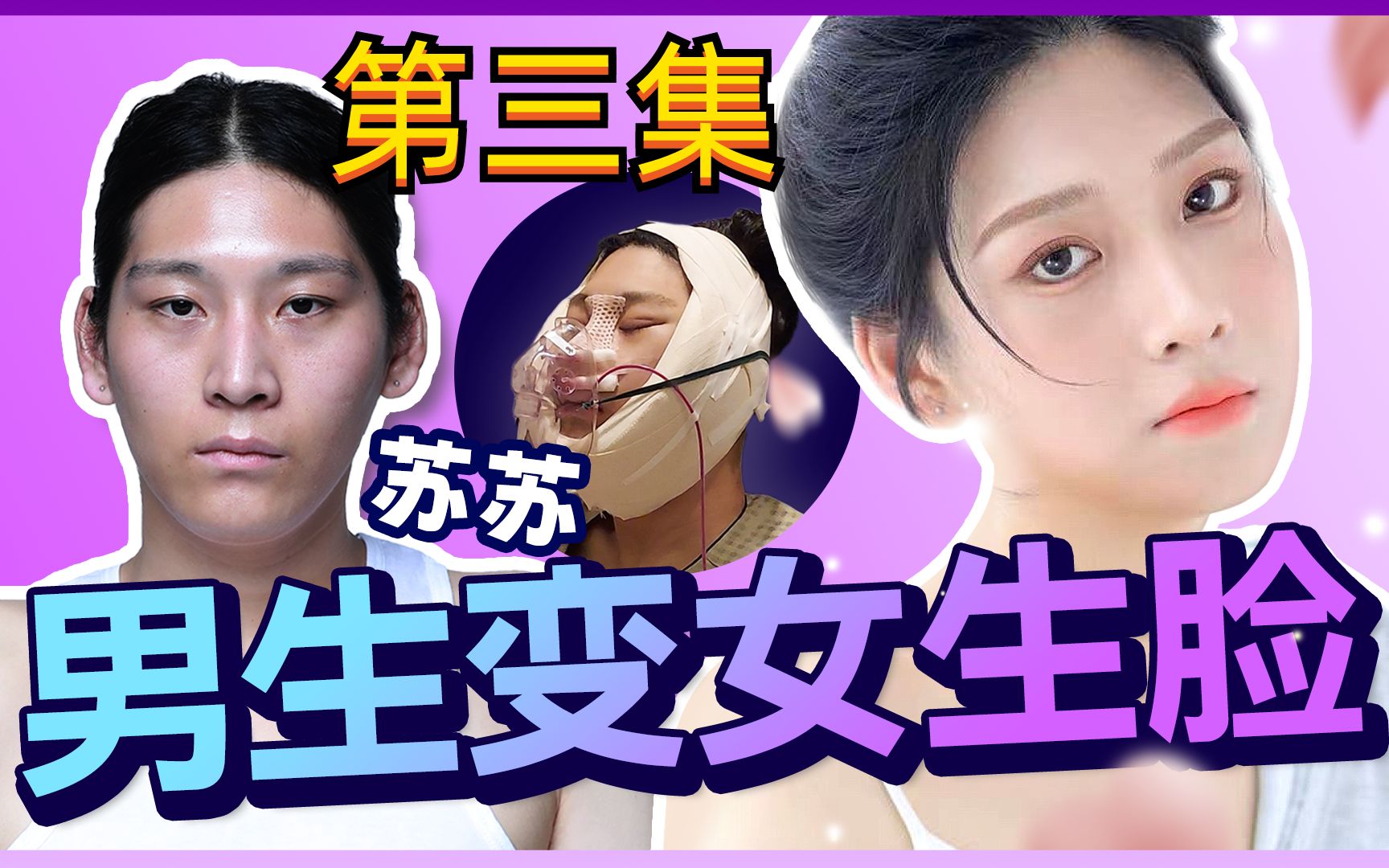 苏酥男生变女生脸整容记_第三集