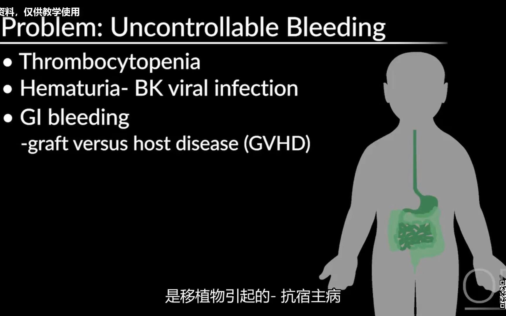 [图]造血干细胞移植HSCT3