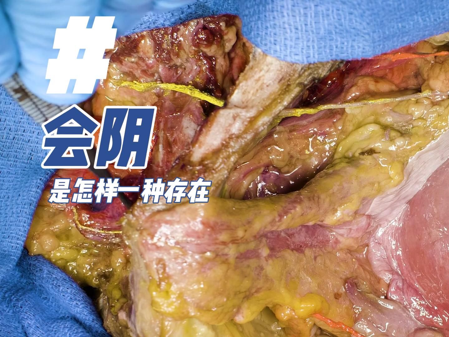 会阴：是怎样一种存在？（1）