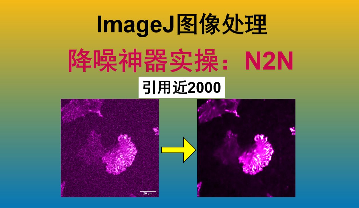 『超实用』ImageJ 降噪神器Noise2Noise简介与实操哔哩哔哩bilibili