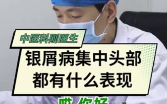 束状发是头部银屑病的典型特征❗❗❗哔哩哔哩bilibili