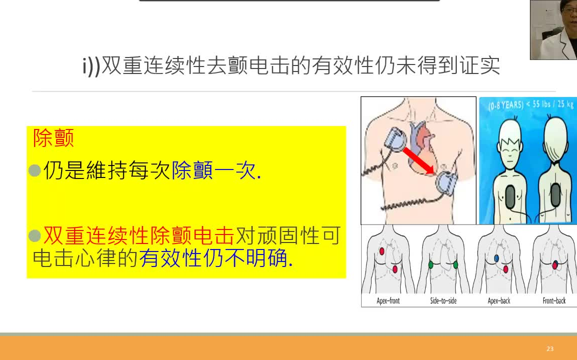 【中华护理学会 ⷠ专科护士培训系列课程】陈永强 解读2020年AHA心肺复苏指南哔哩哔哩bilibili