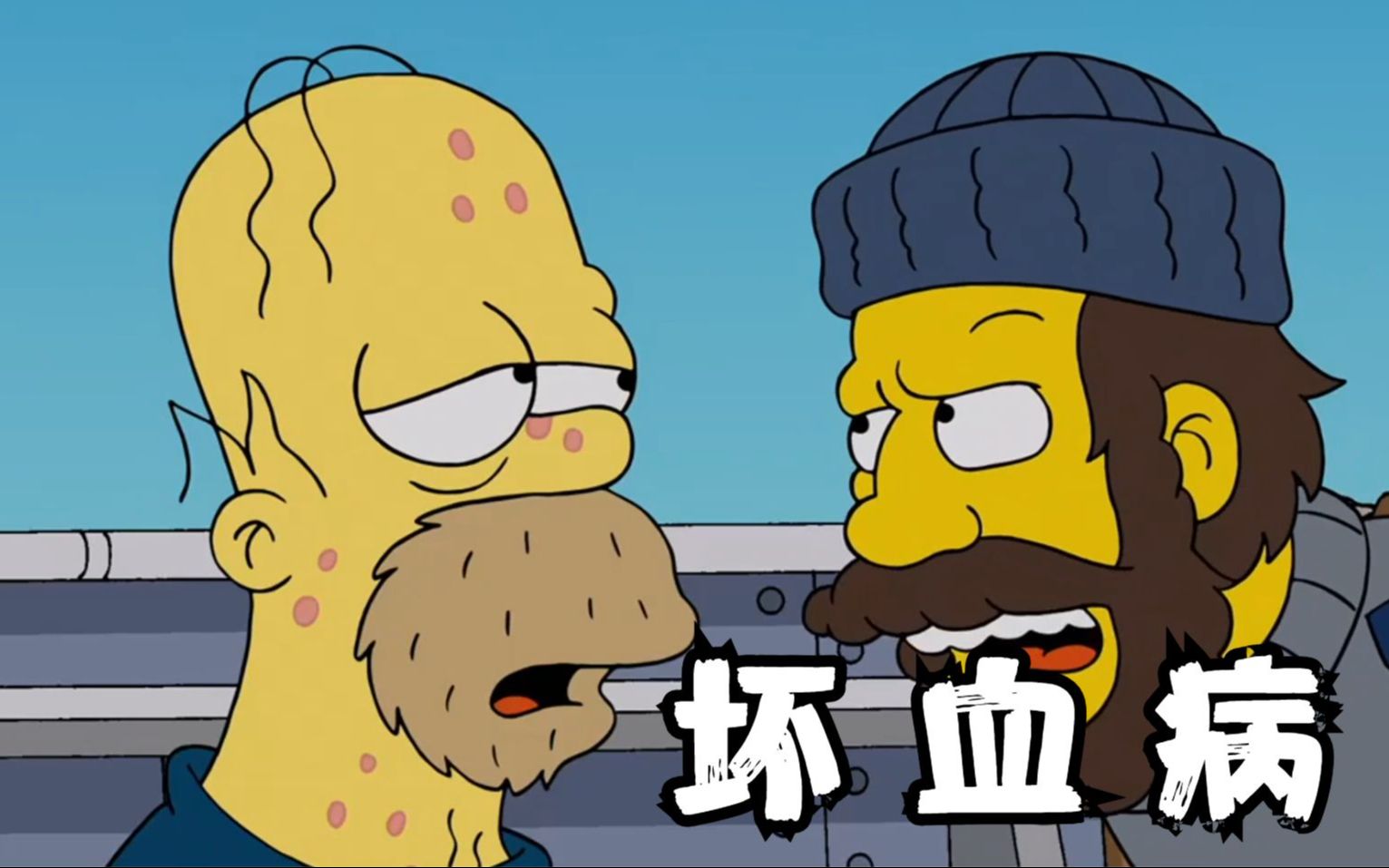 辛普森一家之"坏血病"