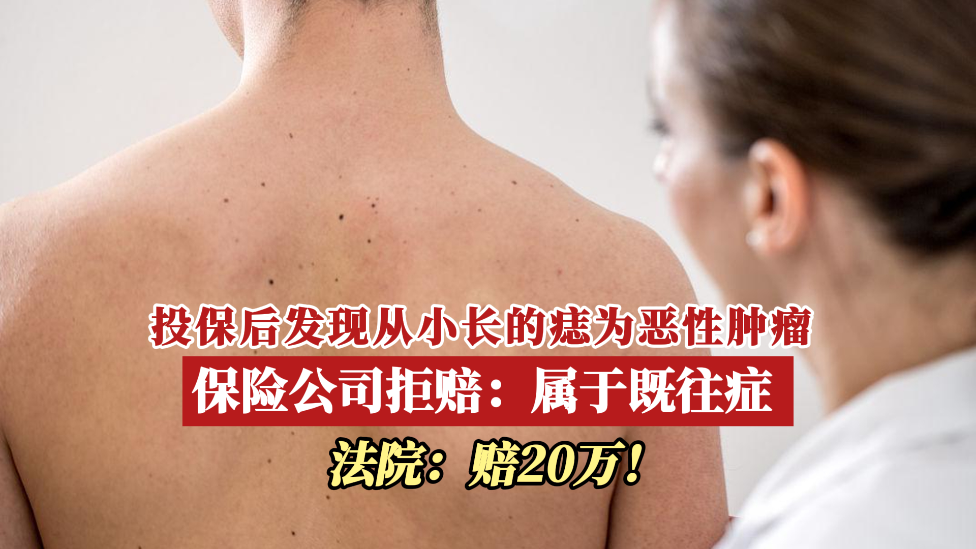 男子投保后发现从小长的痣为恶性肿瘤 遭保险公司拒赔哔哩哔哩bilibili