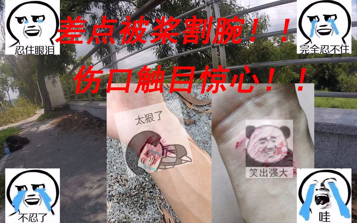 fpv练习手腕被桨打成鱼鳞纹再割深一点就