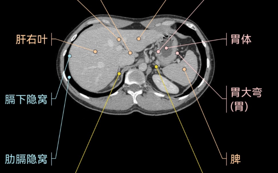 [图]腹部CT断层影像解剖图谱