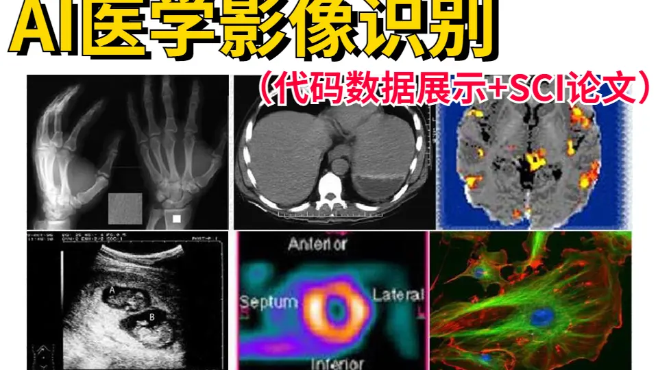 Skin-Lesion-Detector-2:使用InceptionV3 + XGBoost模型预测皮肤癌类型的Python（Flask）网络应用