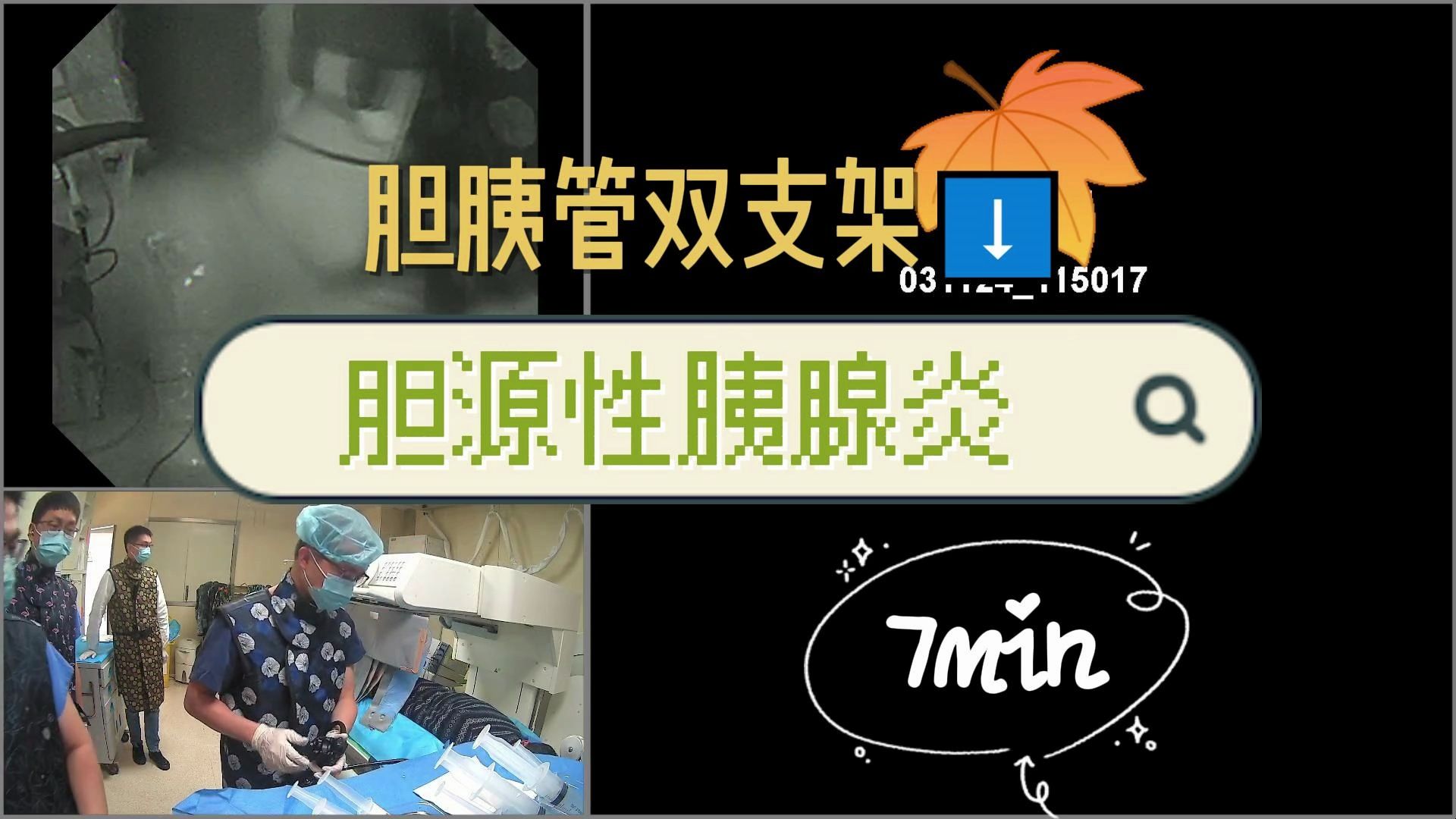 我的ERCP学习日记4哔哩哔哩bilibili