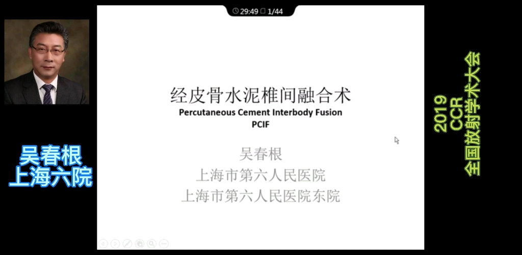 讲座:经皮骨水泥椎间融合术,2019年全国放射学术大会,吴春根介入基础教程177哔哩哔哩bilibili