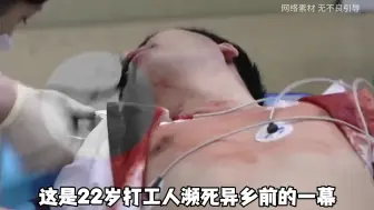 Tải video: 一场牵动无数人的紧急生命大救援 #毒蛇 #纪录片 #医者仁心