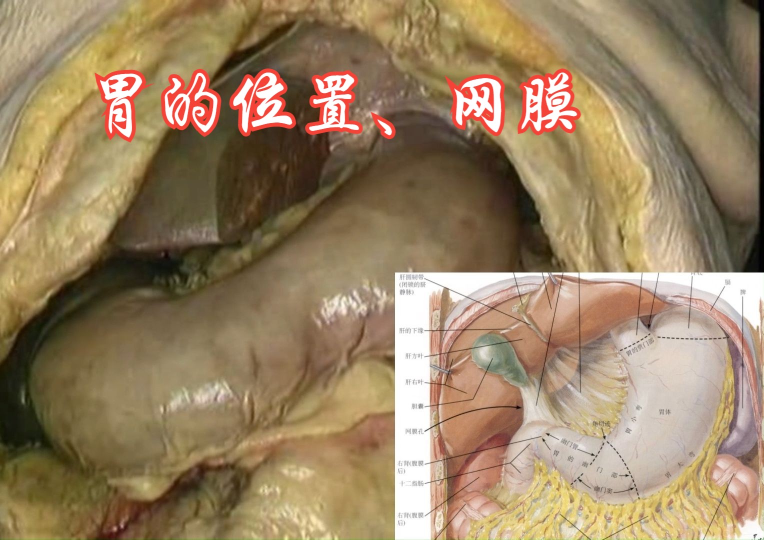 胃的位置、大小网膜哔哩哔哩bilibili