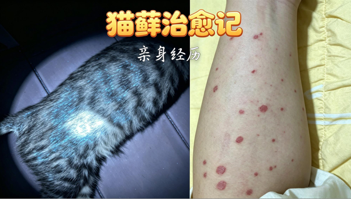 捡流浪猫代价 1700 元！一人一猫全身猫藓，医生劝我直接丢掉