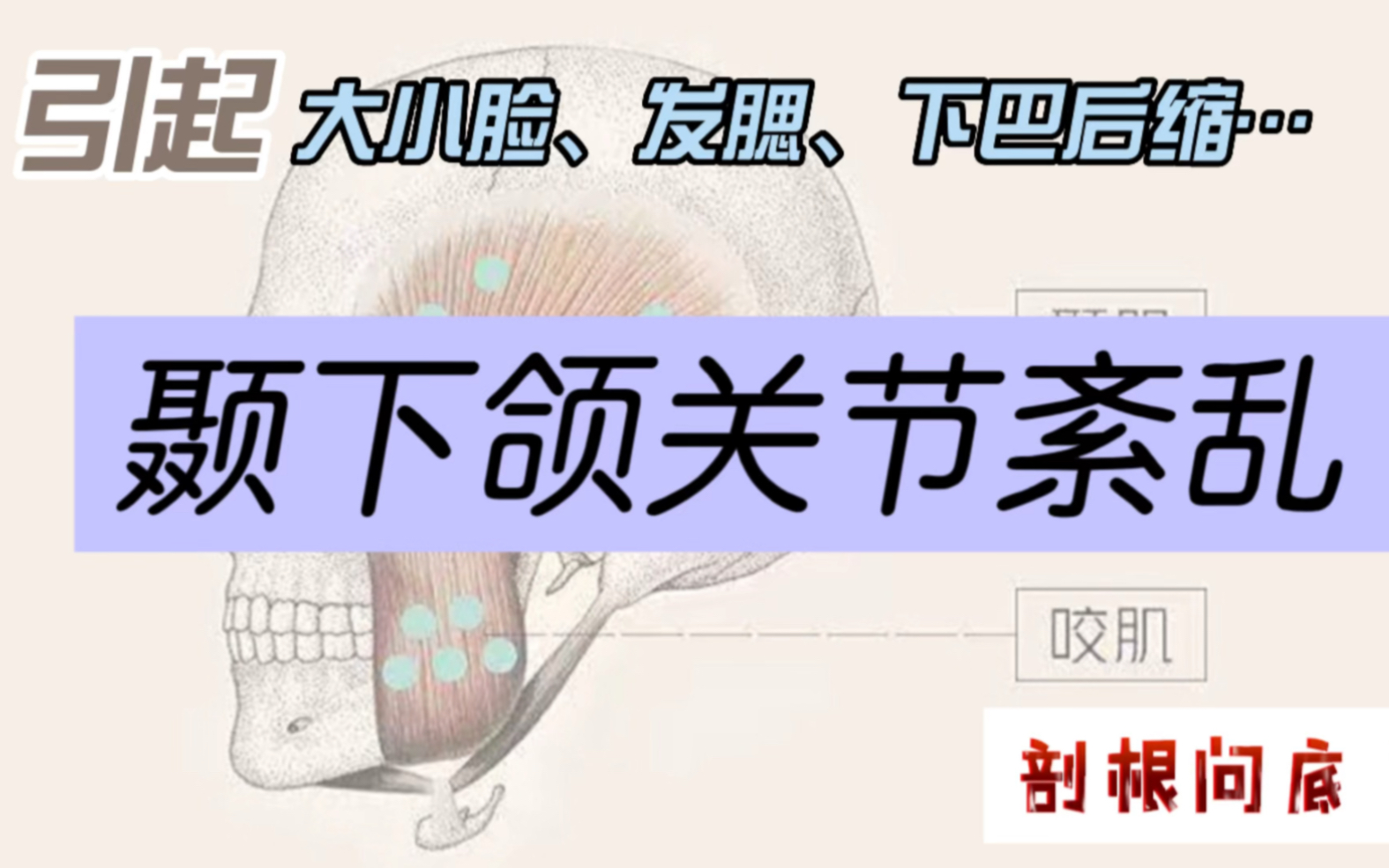 面部形态矫正——颞下颌关节紊乱哔哩哔哩bilibili