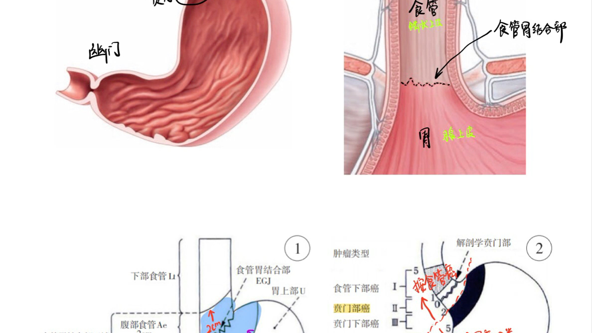 胃镜食管入口解剖图图片