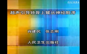 Download Video: 超声引导锁骨上臂丛神经阻滞