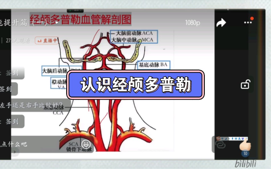 认识经颅多普勒哔哩哔哩bilibili