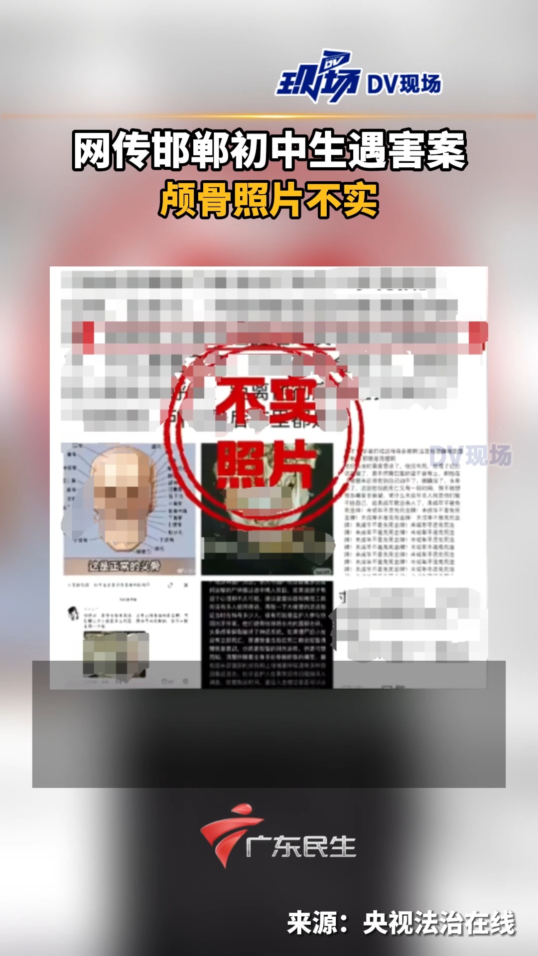 网传邯郸初中生遇害案颅骨照片不实 #河北dou知道哔哩哔哩bilibili