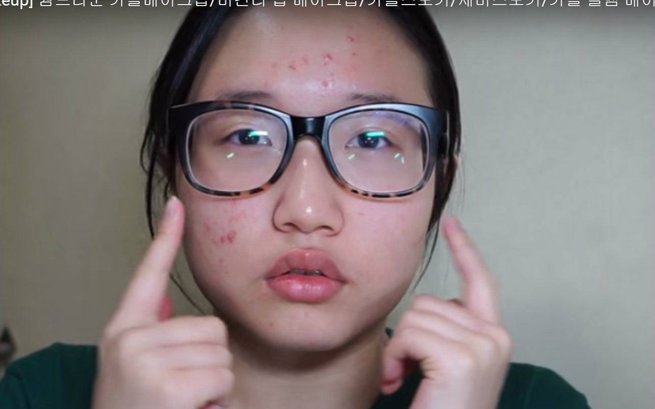 【痘痘?暗沉?眼镜妹whoz大变身萌妹子~!】