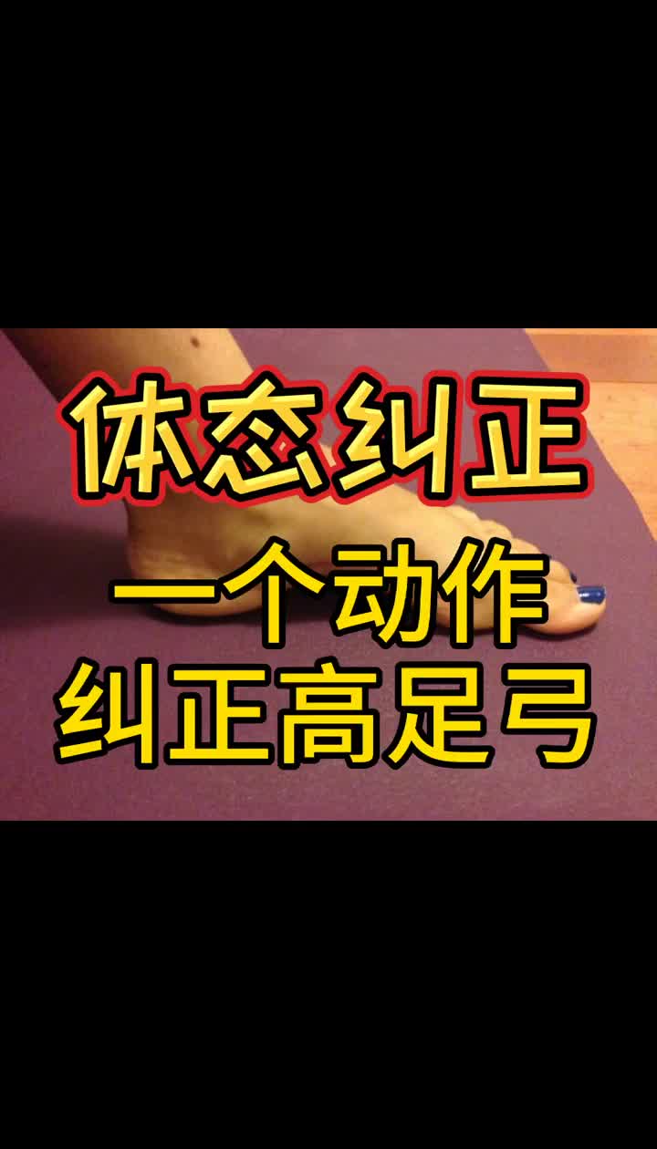 【体态矫正】一个动作纠正高足弓哔哩哔哩bilibili