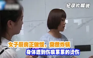 Download Video: 惊险！女子厨房正做饭，突然炸了锅？身体遭到伤痕累累的烫伤！