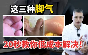 Download Video: 【科普】教你低成本解决，常见的3种脚气问题！