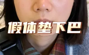 Descargar video: 美女做了假体垫下巴一年多的变化～