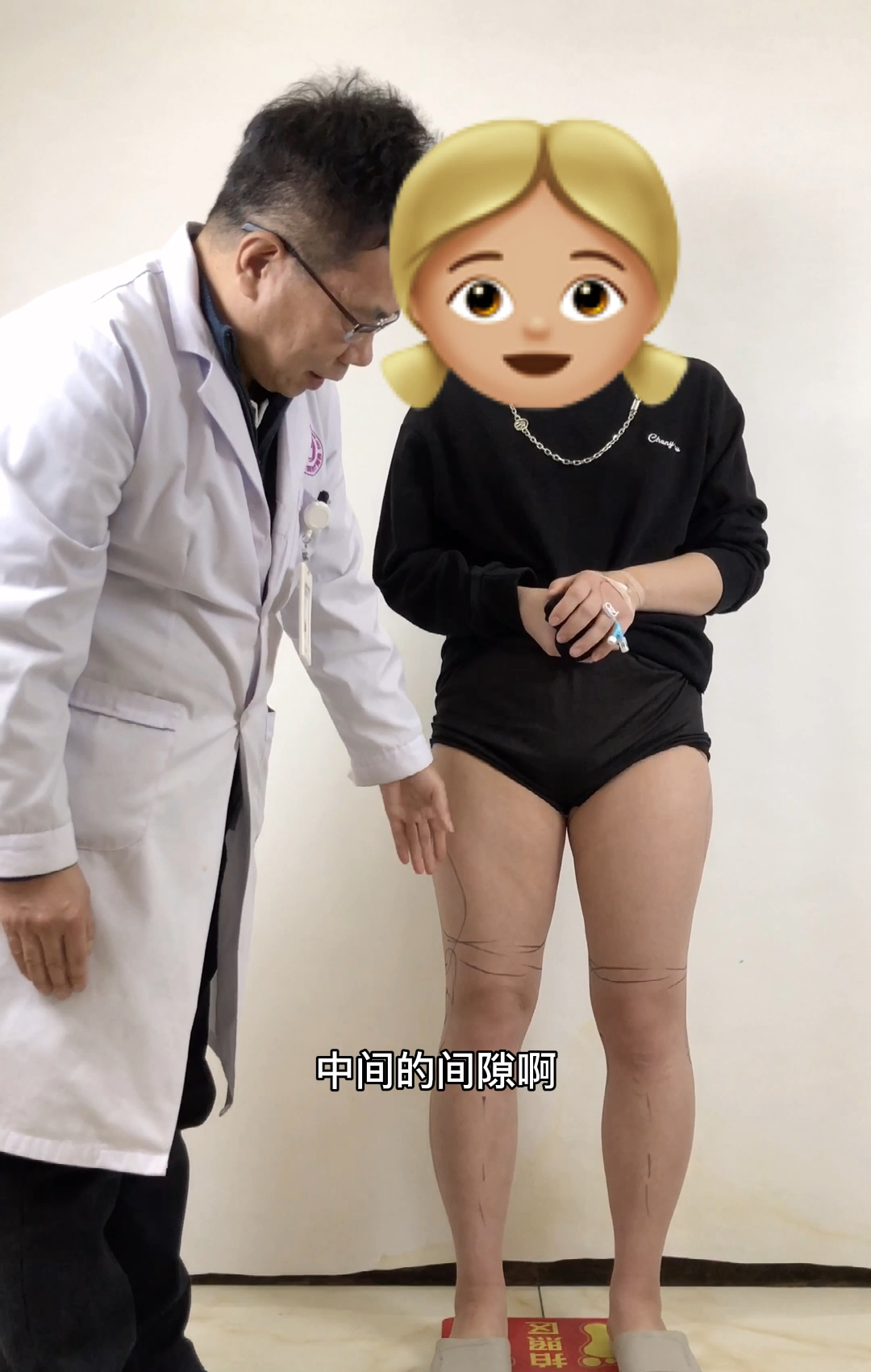 如何把男人腿变成女人腿#瘦腿#哔哩哔哩bilibili