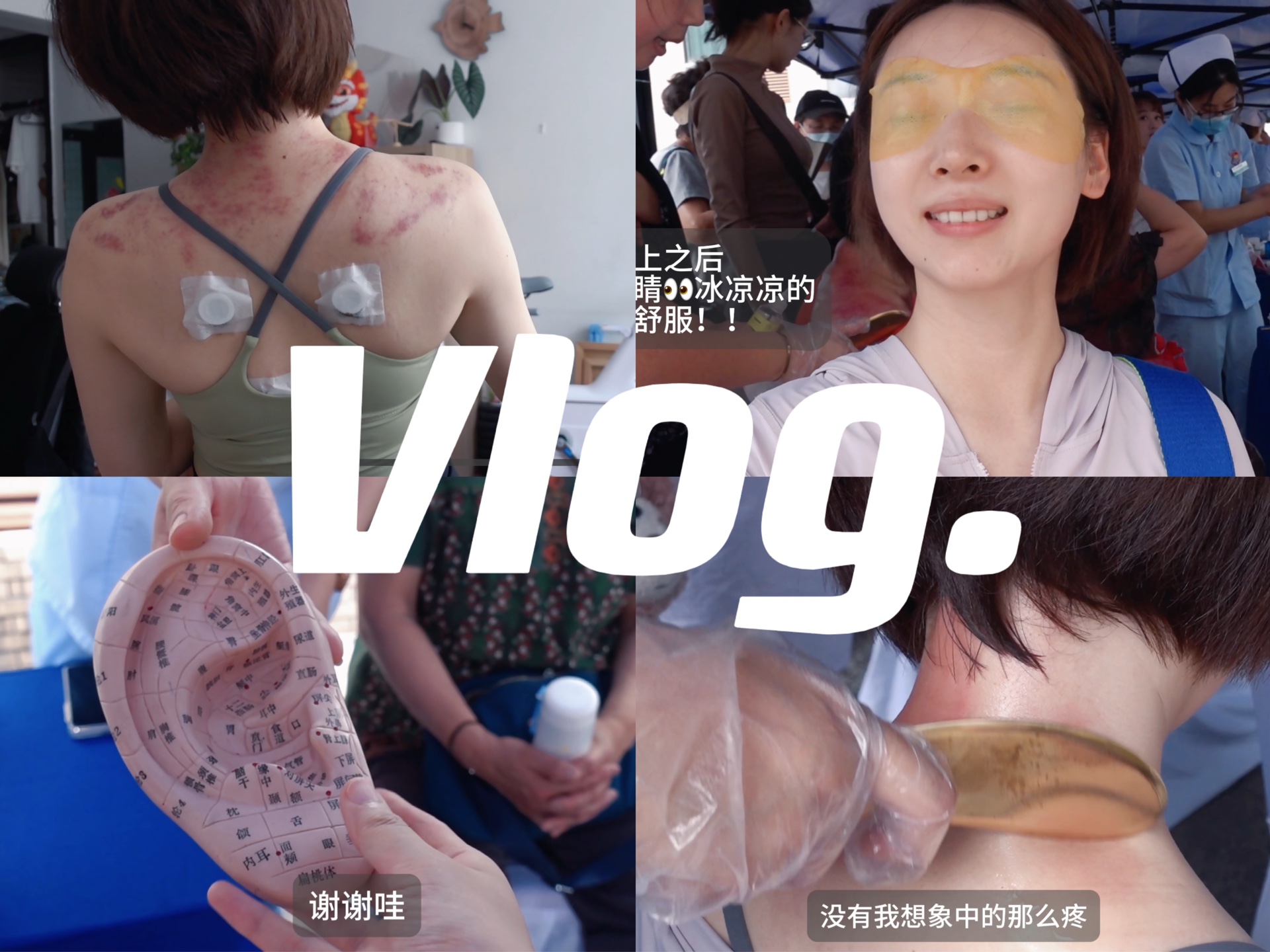 vlog|三伏天养生中医养生的奥秘、三伏贴,刮痧,休息日的花式养生哔哩哔哩bilibili